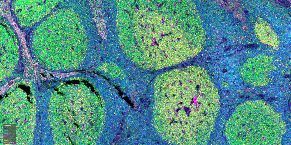 Biobanking and Patient Engagement Building Trust in Biomedical Research 2